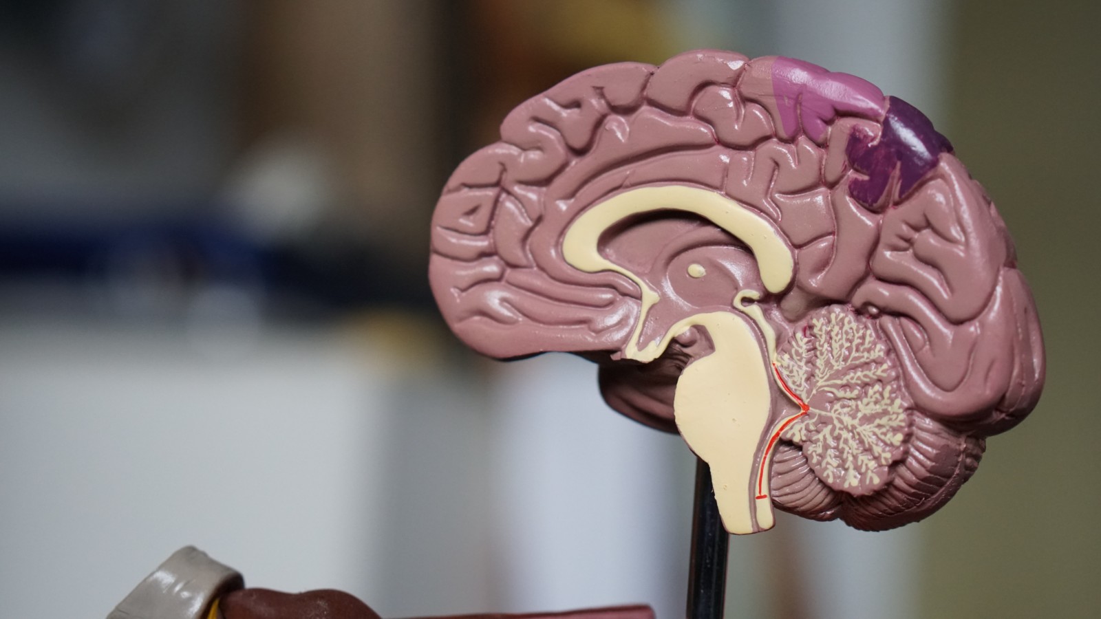 Detailní model lidského mozku z boku, ukazující jeho anatomické části, včetně mozkové kůry, mozečku a mozkového kmene, s důrazem na propojení mastných kyselin a roztroušené sklerózy.